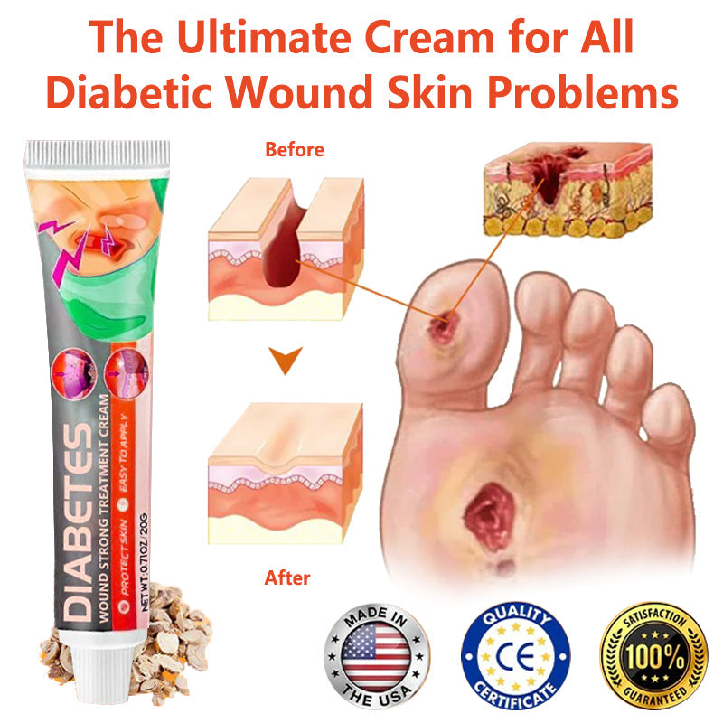 ✨ QIAWI™ Natural Products, Diabetes Wound Strong Treatment Cream (👨‍⚕️ Relieves skin itching, reduces swelling and pain, has antibacterial and anti-inflammatory effects, promotes rapid wound healing, prevents scarring, and is antimicrobial)